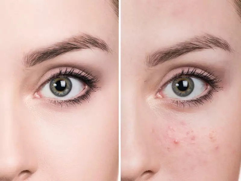 Best foundation for oily skin